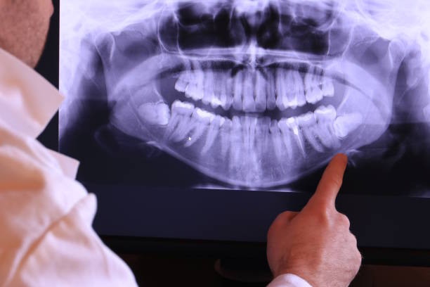 Best Teeth Whitening  in Lla Lla East, WA